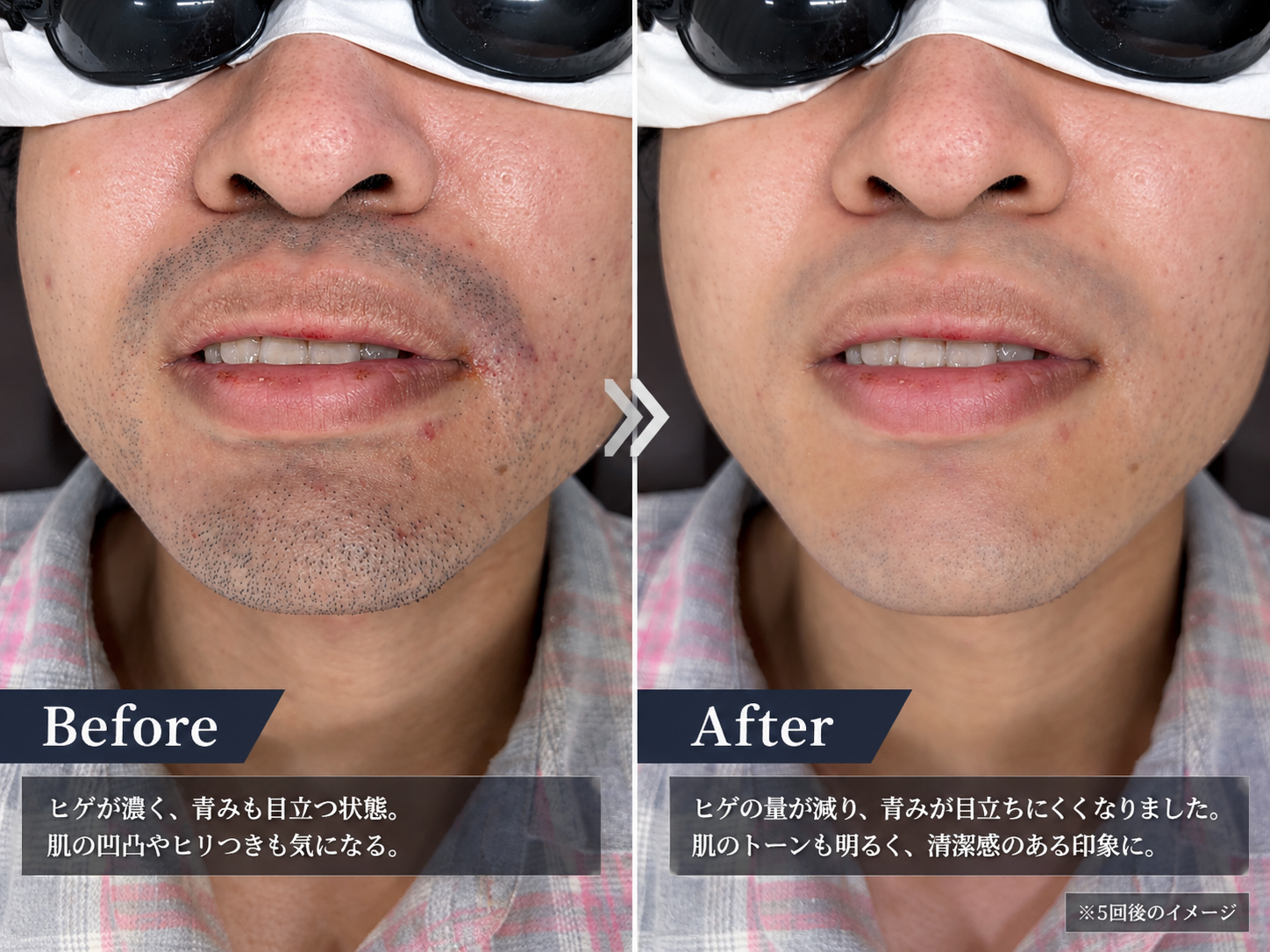 肌トラブルから解放されたい男性の皆様へ✨