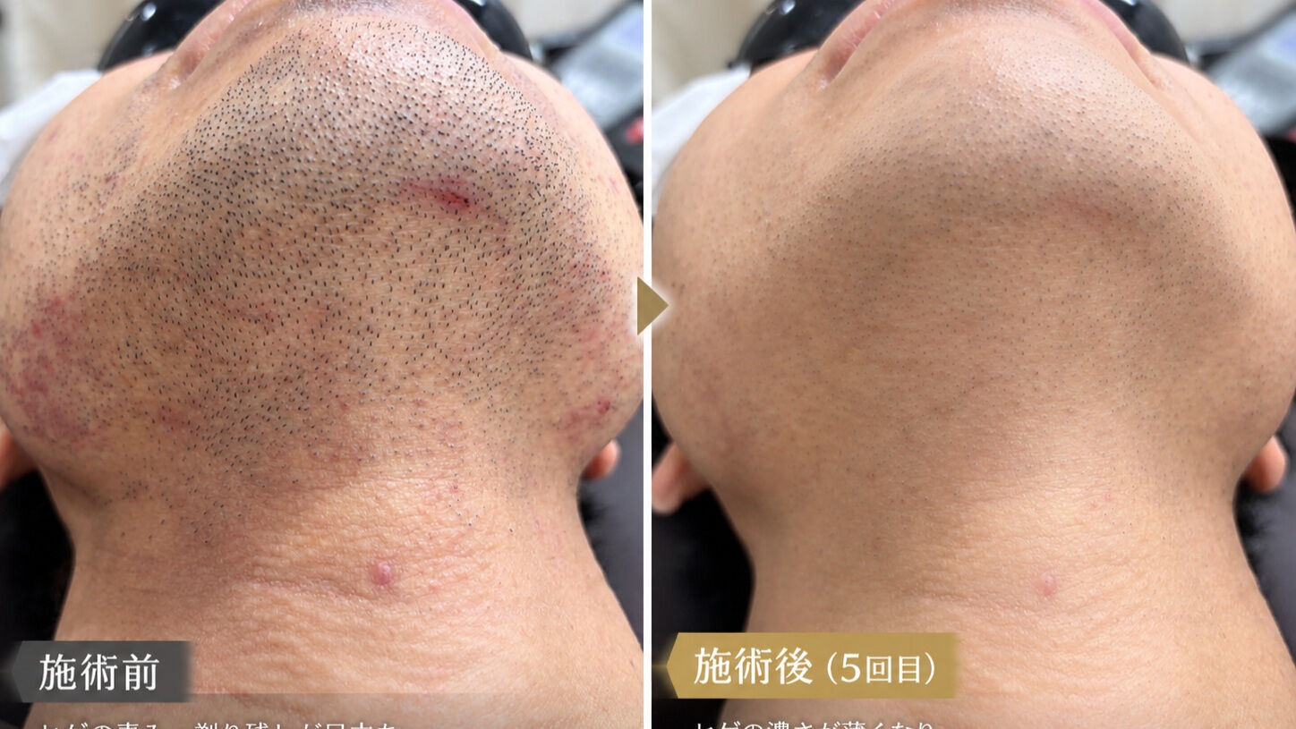 簡単なお手入れへの第一歩